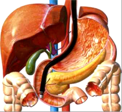 эндосонография средостения верхних отделов желудочно-кишечного тракта