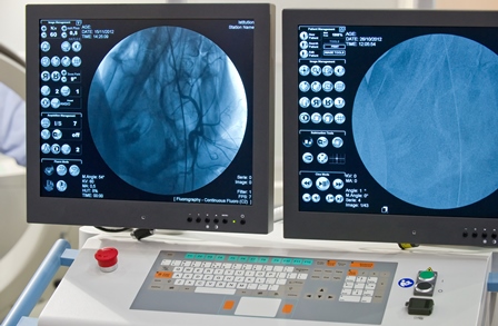 Вентрикулография - ангиокардиография (левая и правая)